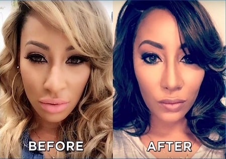 In picture, Hazel-E before and after her nose job.